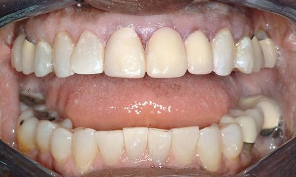 Before & After Gallery 19 10 - Before