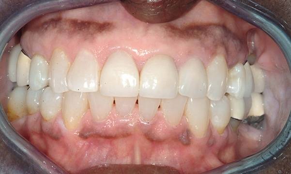 Before & After Gallery 20 10 - After