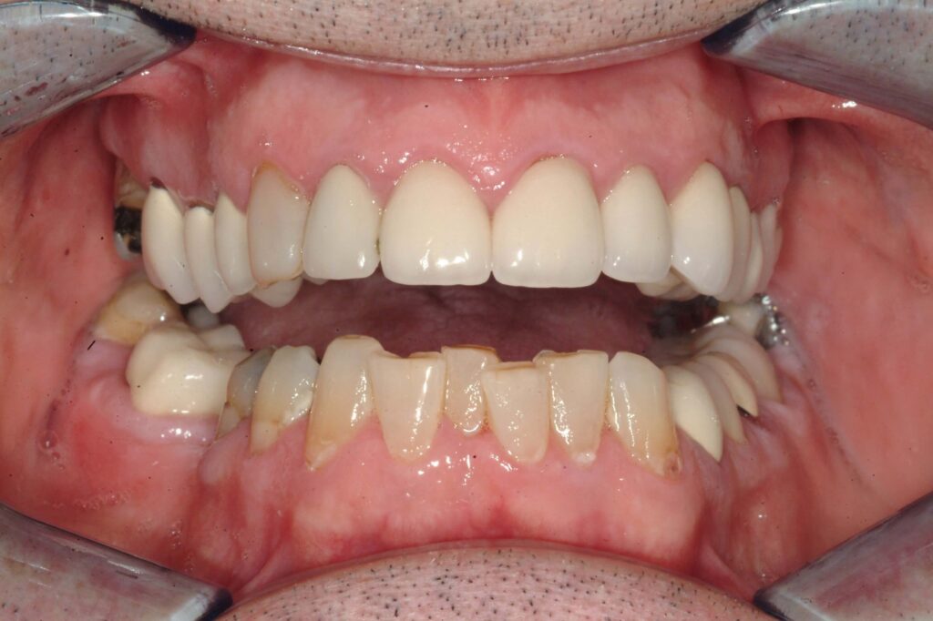 Before & After Gallery 24 12 - After