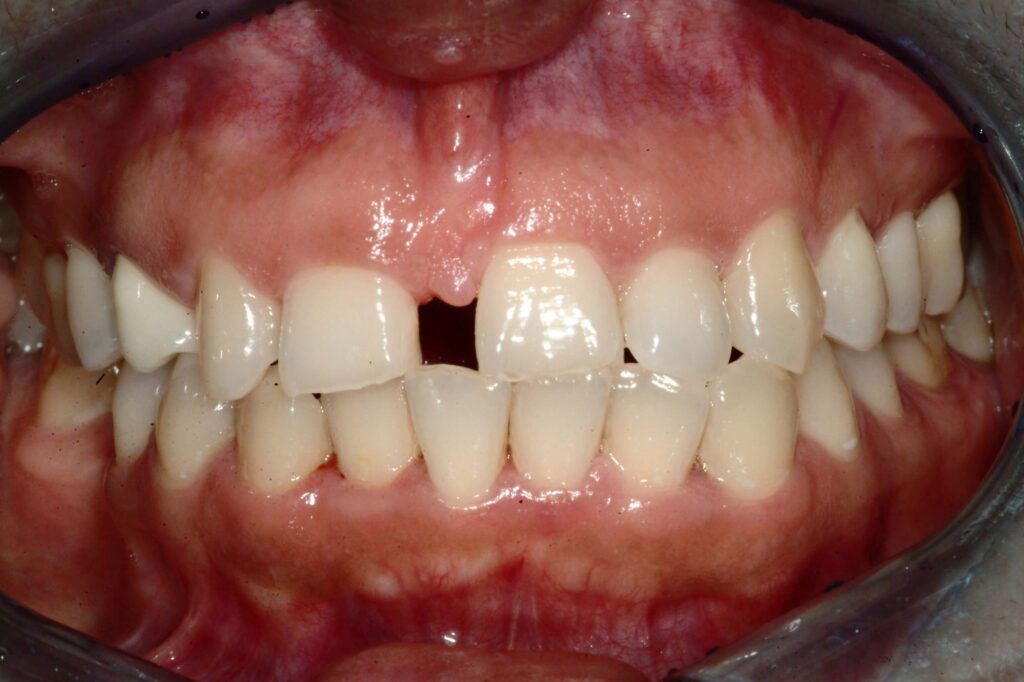 Before & After Gallery 31 16 - Before