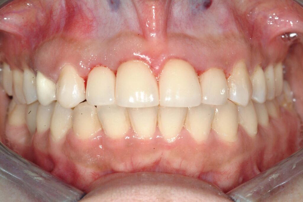 Before & After Gallery 32 16 - After