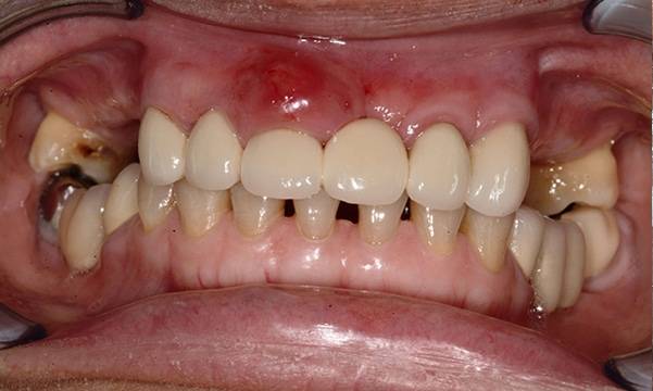 Before & After Gallery 1 1 - Before