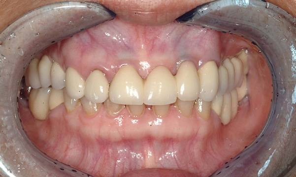 Before & After Gallery 2 1 - After