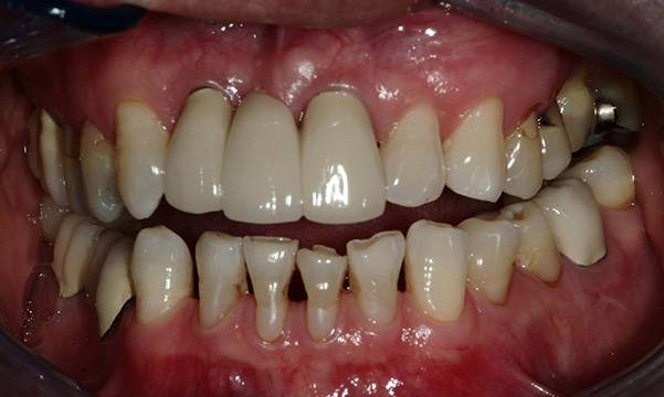 Before & After Gallery 3 2 - Before