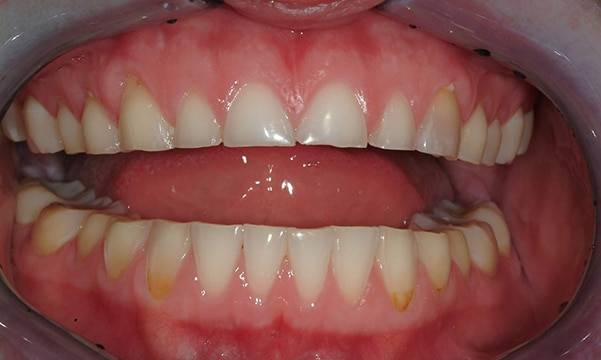 Before & After Gallery 5 3 - Before