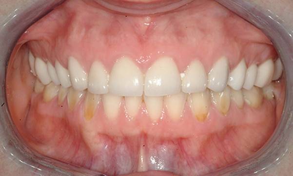 Before & After Gallery 6 3 - After