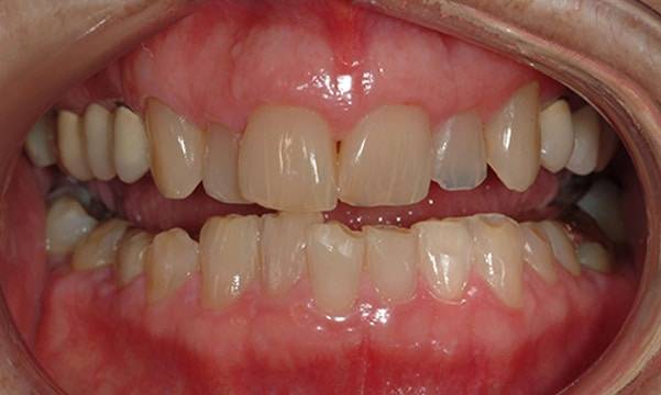 Before & After Gallery 7 4 - Before