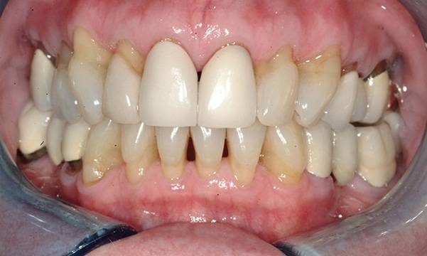 Before & After Gallery 9 5 - Before