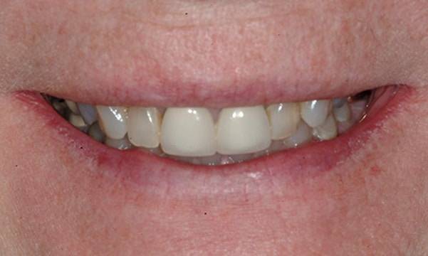 Before & After Gallery 15 8 - Before