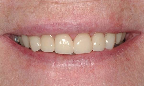 Before & After Gallery 16 8 - After