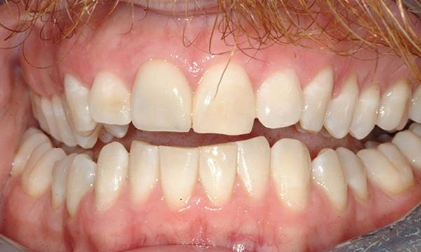 Before & After Gallery 18 9 - After